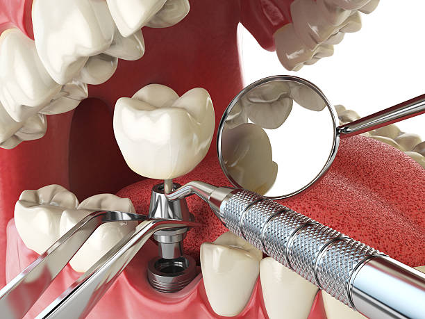 Best Walk-In Emergency Dentist in Gladstone, MO